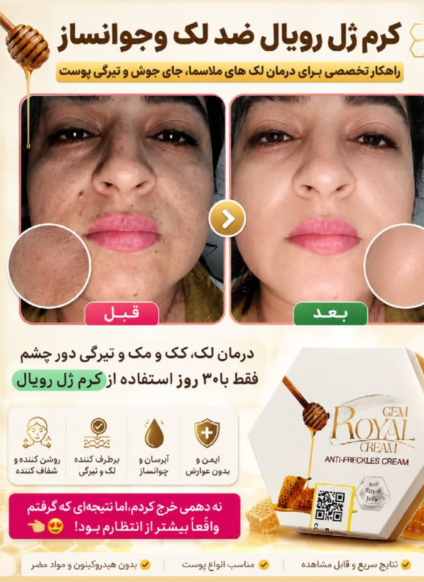 کرم ضد لک و جوانساز ژل رویال تک