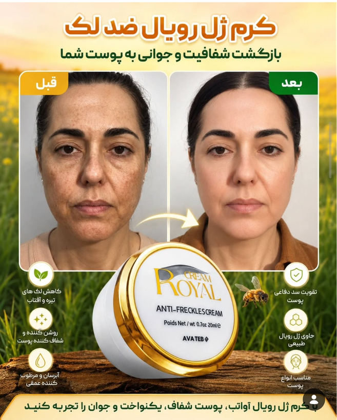 کرم ضد لک و جوانساز ژل رویال تک